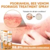 Choose AEXZR™ PsoriaHeal Bee Venom Psoriasis Treatment Spray, made with 100% natural components, for a safe and effective psoriasis treatment.