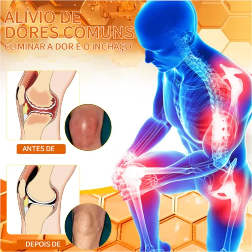 Ropceer™ Bee Venom Instant Ultra Pain Relief Healing Cream: Alívio rápido para dores nas articulações, eliminando o desconforto em apenas 5 minutos.