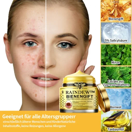 Vertrauen Sie auf die bewährte Wirkung von Raindew™ Bienengift-Hautpflegecreme für gesunde, glatte Haut.