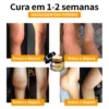 Ropceer™ Bee Venom Instant Ultra Pain Relief Healing Cream: Sua solução natural para dores, combinando eficácia e satisfação do cliente em um só produto.