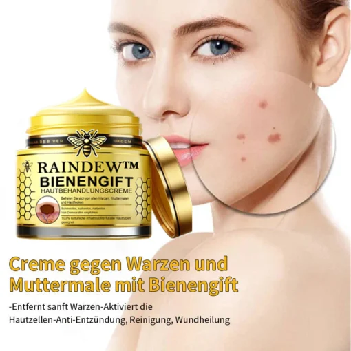 Erleben Sie, wie Raindew™ Bienengift-Hautpflegecreme Warzen sanft entfernt und Ihre Haut revitalisiert.