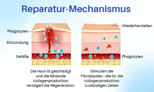 Oveallgo™ Silikon Anti-Narbencreme unterstützt die Hautheilung und sorgt für ein jugendlicheres Aussehen.