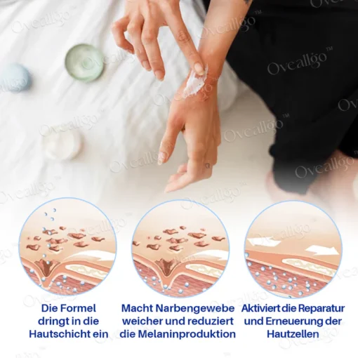 Oveallgo™ SilkScar Narbenbehandlung & Hautreparatur-Serum fördert die Heilung und sorgt für eine weichere, geschmeidigere Haut.