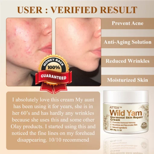 Restore your confidence with ATTDX™ Wild Yam Hormonal Skin Repair Cream by balancing your hormones.