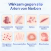 Oveallgo™ Silikon Anti-Narbencreme hilft, die natürliche Elastizität Ihrer Haut wiederherzustellen und Narben weniger sichtbar zu machen.