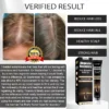 Users report a 50% reduction in hair thinning after using LOVILDS™ Alopecia Recovery Hair Booster Roll-On.