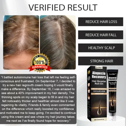 Users report a 50% reduction in hair thinning after using LOVILDS™ Alopecia Recovery Hair Booster Roll-On.