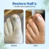 SEAGRIL™ Anti-Fungal Nail Repair Ointment targets nail infections quickly, providing a perfect solution for strong and shiny nails.