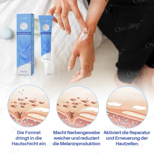 Oveallgo™ Silikon Anti-Narbencreme ist die perfekte Lösung zur Verringerung von Keloid- und Aknenarben.