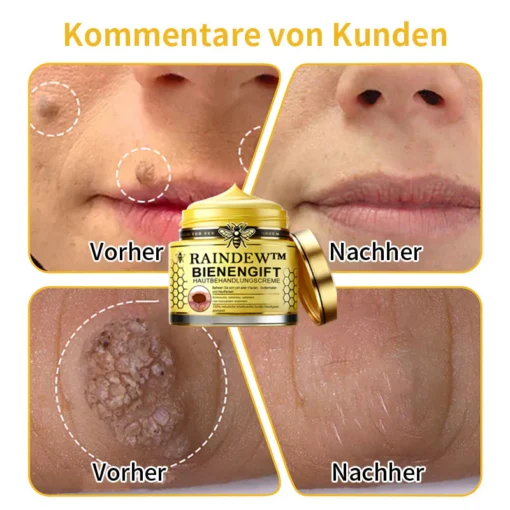 Mit Raindew™ Bienengift-Hautpflegecreme sehen Sie innerhalb von 2 Wochen signifikante Verbesserungen Ihrer Haut.