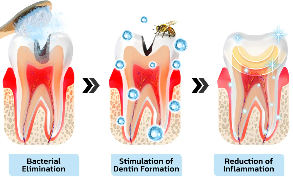 Fivfivgo™ Bee Venom Treatment Powder is effective in treating cavities, providing relief and promoting dental health.