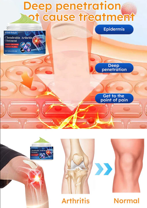 Say goodbye to pain with Fivfivgo™ Chondroitin Arthritis Ointment, recommended by orthopedic surgeons for arthritis treatment.