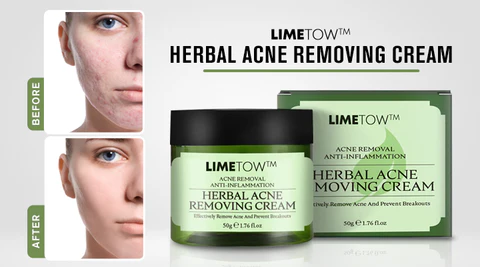 LIMETOW™ Herbal Acne Removal Cream helps fade acne scars, leaving your skin looking healthy and radiant with continued use.