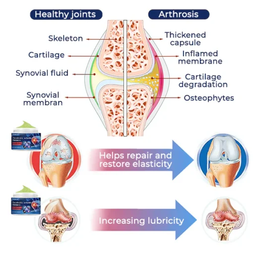 Feel the difference with Fivfivgo™ Chondroitin Arthritis Ointment, designed to enhance joint health and reduce pain quickly.