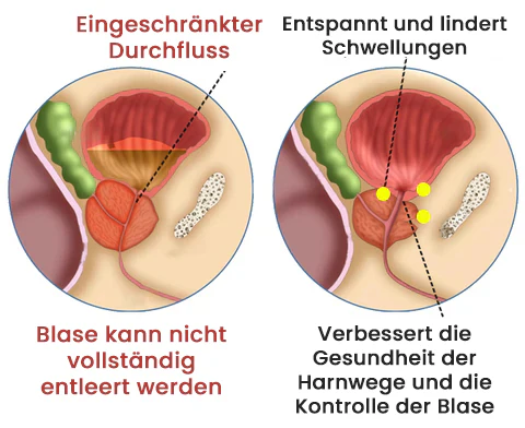 AEXZR™ Detox Prostata-Pflaster hilft, die Prostata auf natürliche Weise zu entgiften und die allgemeine Gesundheit zu fördern.