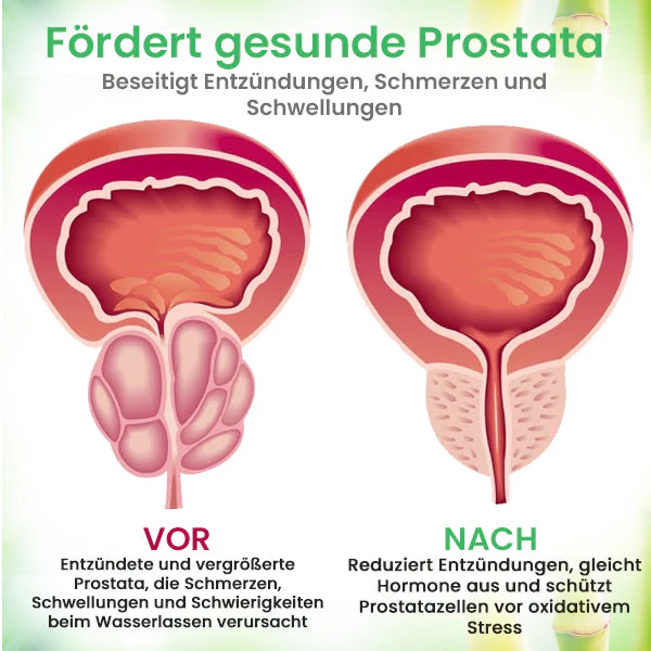 AEXZR™ Detox Prostata-Pflaster fördert die natürliche Entgiftung und hilft bei der Linderung von Prostataentzündungen.