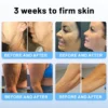 Experience the benefits of Flysmus™ Wrinkle Removal Cream and join the many satisfied customers who have transformed their skin!