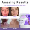 AEXZR™ Violet Eczema Treatment Cream minimizes chemical risks, providing a safe and natural alternative for skin treatment.