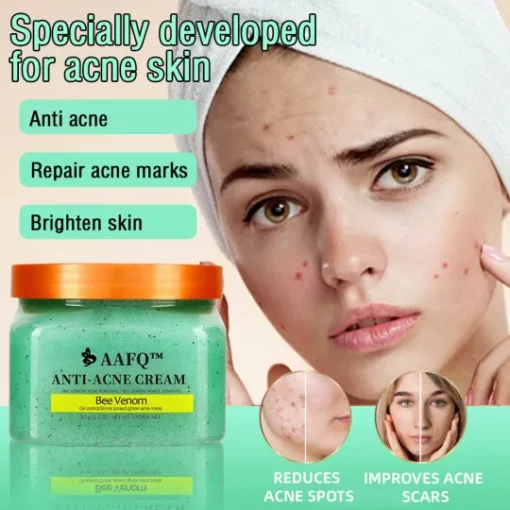 AAFQ™ Bee Venom Anti-Acne Cream minimizes acne scars, making it the ideal choice for skin recovery.