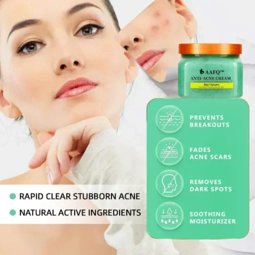 Enjoy quick, lasting results with AAFQ™ Bee Venom Anti-Acne Cream. Start your journey to clear skin today!