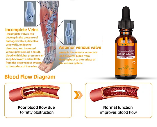 AAFQ™ Lymphatic Detoxification & Anti-inflammatory Slimming Drops provide relief from varicose veins while promoting a healthier body.