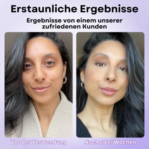 Genießen Sie die sofortige Straffung der Haut mit AEXZR™ Augenschwellungs Entferner Creme – für einen strahlenden, jugendlichen Blick.