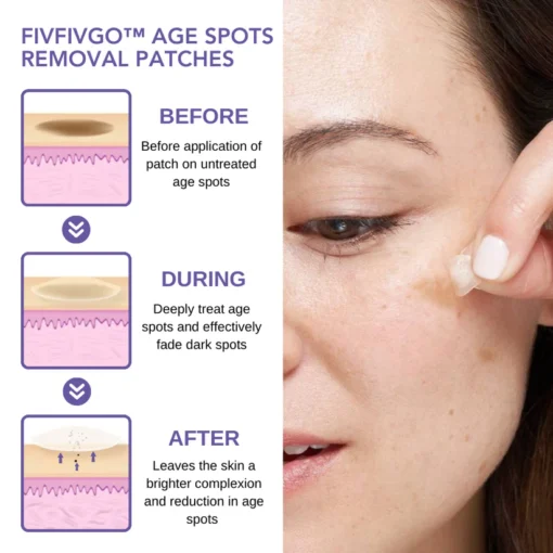 Fivfivgo™ Age Spots Removal Patches combine comfort and effectiveness, making them a go-to solution for those looking to reclaim their glow.