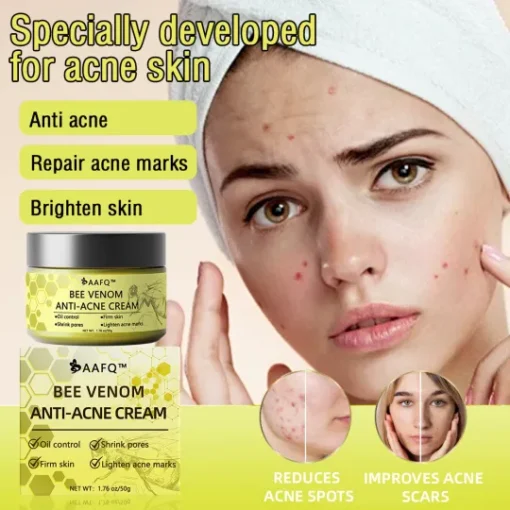 Bee Venom AAFQ™ Anti-Acne Cream promises visible results in just weeks, tackling all types of acne effectively and painlessly.