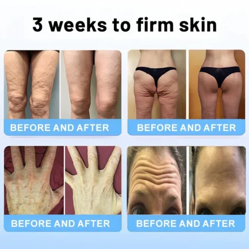 Experience the magic of Flysmus™ Wrinkle Removal Cream! Users report improved elasticity and reduced wrinkles within weeks of use.