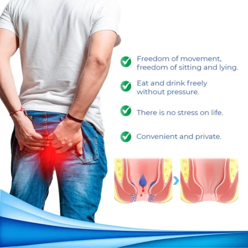 Suffering from hemorrhoids? Fivfivgo™ Herbal Hemorrhoid Relief Cream targets pain and inflammation with a powerful herbal formula for effective relief.