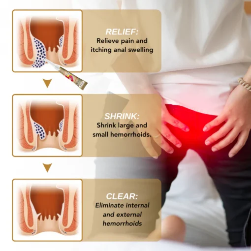 Experience fast relief from discomfort with Fivfivgo™ Hemorrhoid Natural Ointment. Its natural ingredients help soothe painful symptoms effectively.