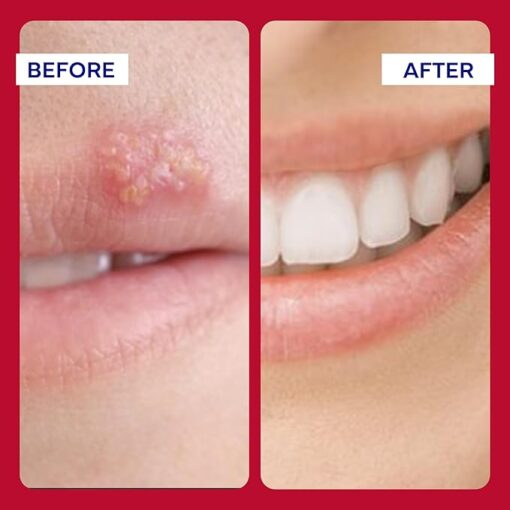 EMUAIDMAX® First Aid Ointment helps soothe skin irritations and reduce inflammation for quick relief.