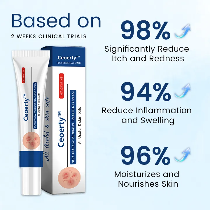 Ceoerty™ SootheGlow Psoriasis Treatment Cream helps prevent future psoriasis flare-ups and boosts skin health.