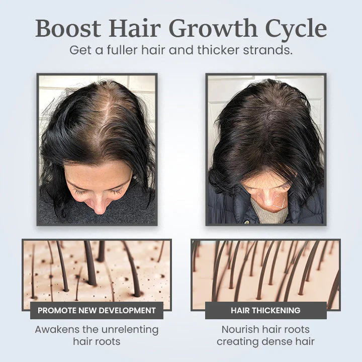 Ceoerty™ ThickTress Hair Growth Spray is clinically proven to stop hair loss.