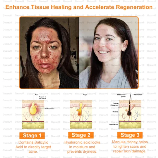 Daasry® All-Body Skin Treatment Cream offers an effective solution for psoriasis and eczema.