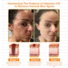 Daasry® All-Body Skin Treatment Cream nourishes and increases skin elasticity.