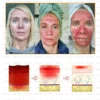 Daasry® All-Body Skin Treatment Cream soothes dry and acne-prone skin, promoting healing.