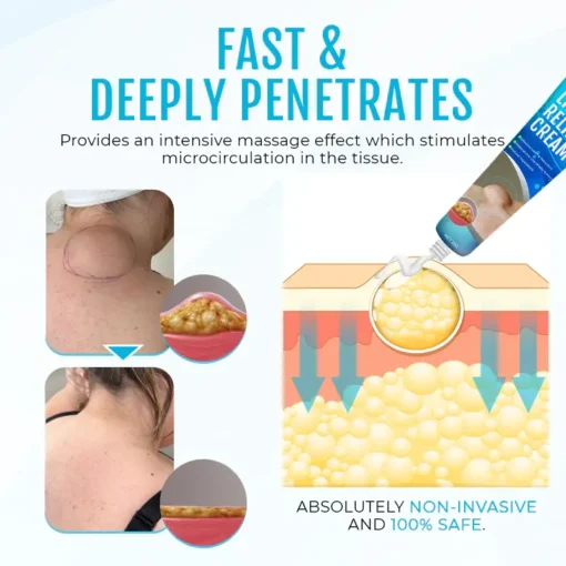 Fivfivgo™ LumpClear Lipoma Relief Cream