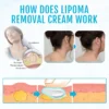 Fivfivgo™ LumpClear Lipoma Relief Cream