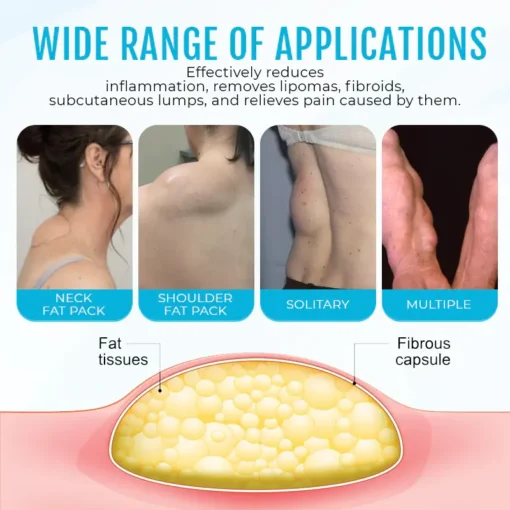 Fivfivgo™ LumpClear Lipoma Relief Cream