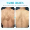 Fivfivgo™ LumpClear Lipoma Relief Cream