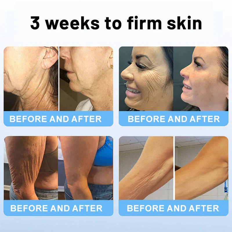 Flysmus™ Collagen Peptides Firming Serum reduces cellulite and firms skin.