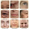 Furzero™ Botox Bienengift Faltenentfernungscreme hilft, den Hautton auszugleichen und Falten zu mindern.