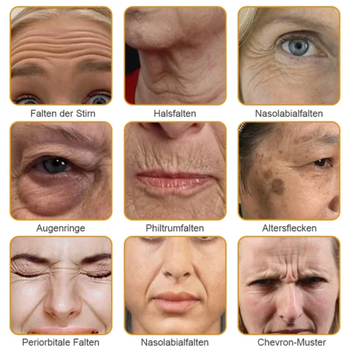 Furzero™ Botox Bienengift Faltenentfernungscreme hilft, den Hautton auszugleichen und Falten zu mindern.