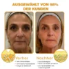 Furzero™ Botox Bienengift Faltenentfernungscreme fördert die Kollagenproduktion für festere Haut.