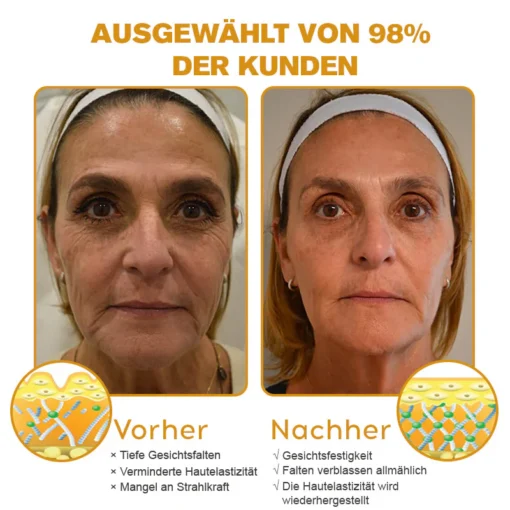 Furzero™ Botox Bienengift Faltenentfernungscreme fördert die Kollagenproduktion für festere Haut.