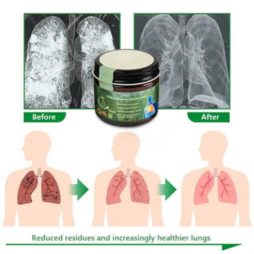 Lercea™ Mullein Clear Lung Repair Cream – Convenient, effective lung-cleansing cream.