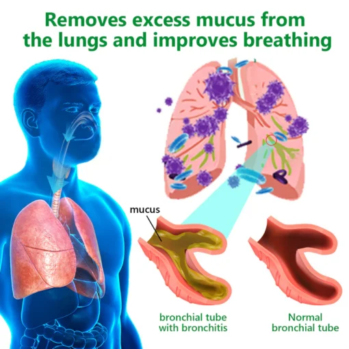 Lercea™ Mullein Clear Lung Repair Cream – Ideal for asthma and allergy relief.