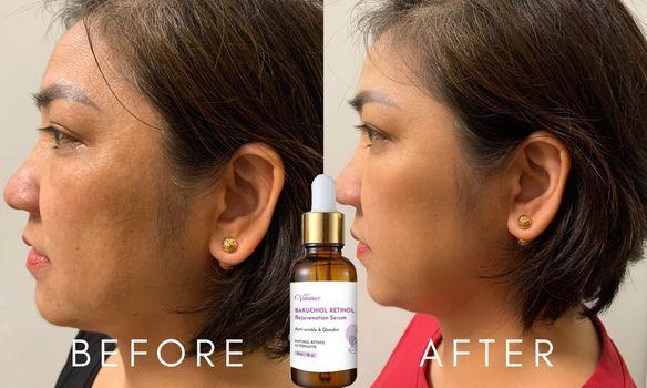 Venature™ Bakuchiol Retinol Rejuvenation Serum renews the skin naturally.