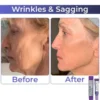 LOVILDS Retinol Intense Advanced Triple Action Eye Cream